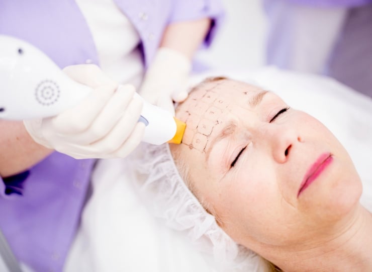Dermatologist providing thermage treatment to woman's forehead